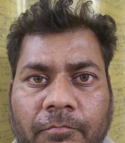 Bhind Robbery Case Cracked: Two Accused Arrested from Etawah, Gold Chain Recovered